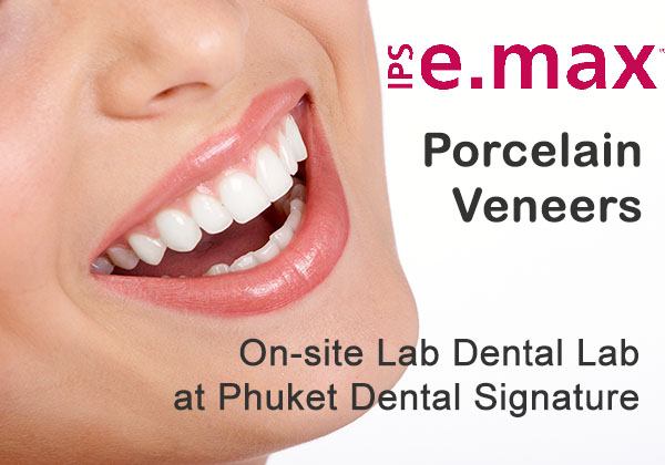 Phuket Dental Veneers